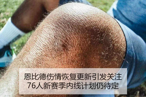 恩比德伤情恢复更新引发关注 76人新赛季内线计划仍待定